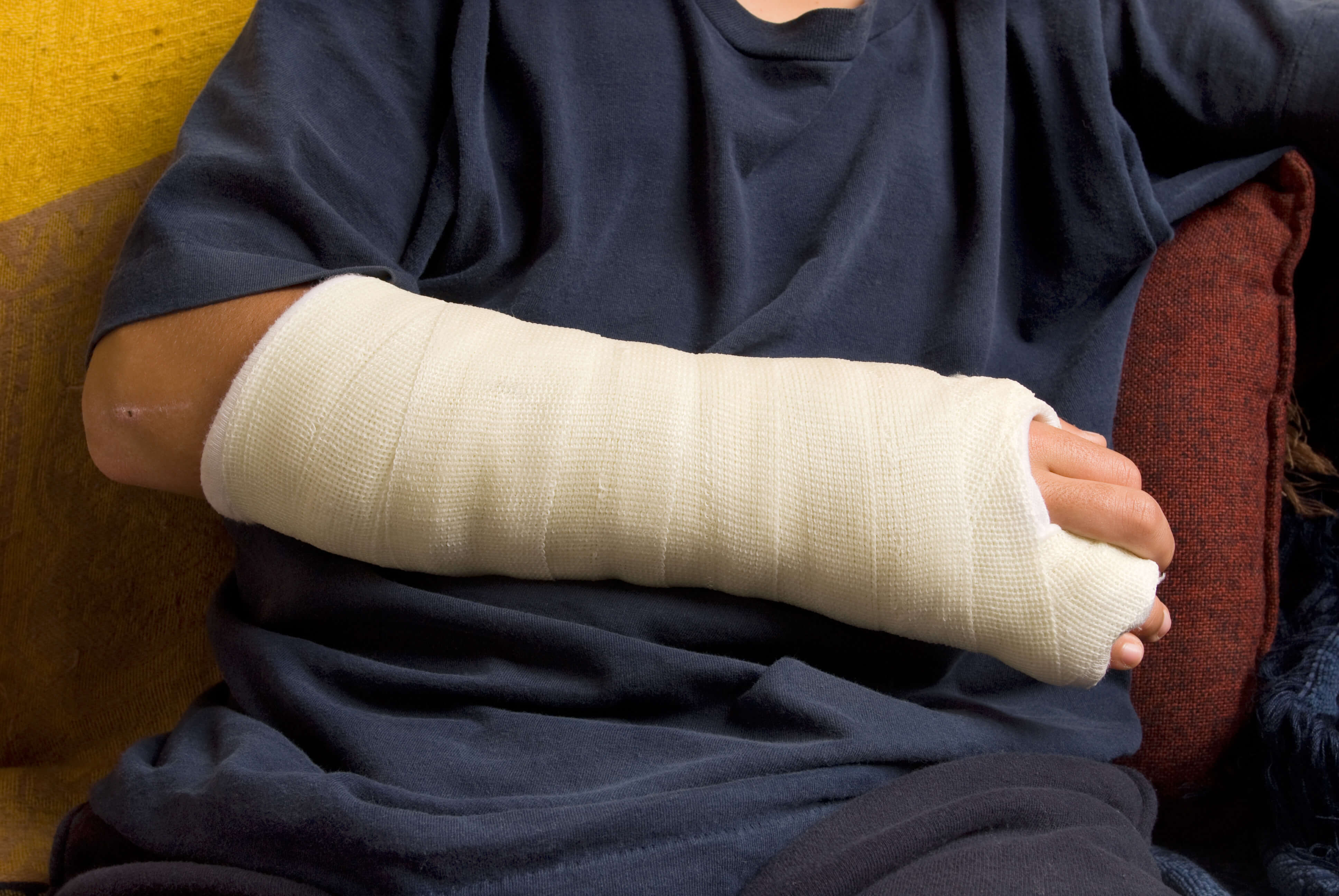 Arm cast of injured person