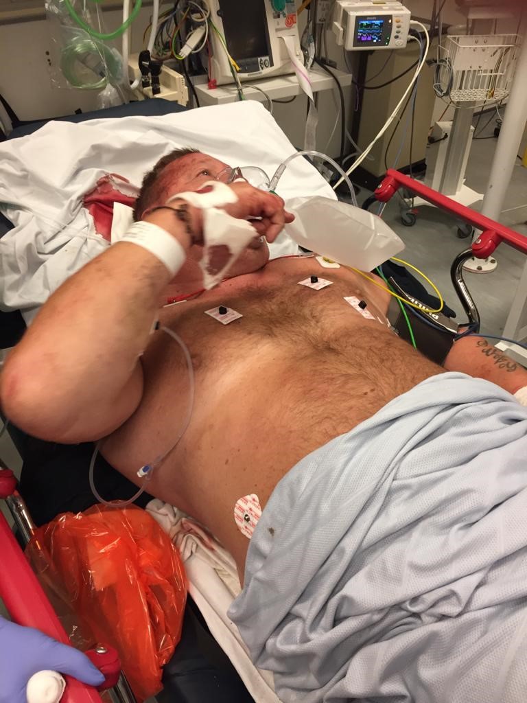 Paul Ashley in hospital
